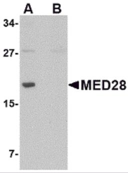 Western blot analysis of MED28 in human brain tissue lysate with MED28 antibody at 1 μg/mL in (A) the absence and (B) the presence of blocking peptide.