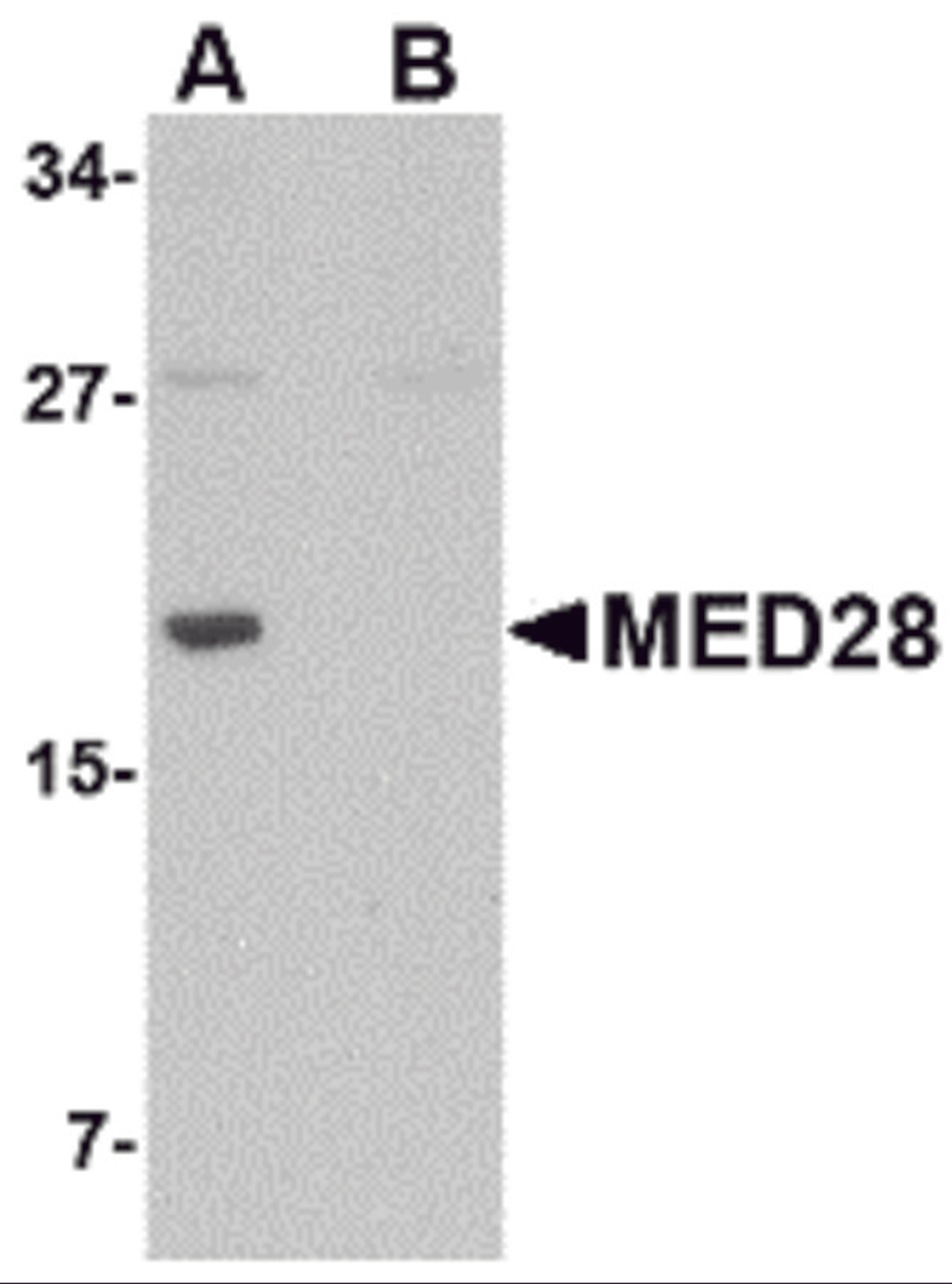 Western blot analysis of MED28 in human brain tissue lysate with MED28 antibody at 1 μg/mL in (A) the absence and (B) the presence of blocking peptide.