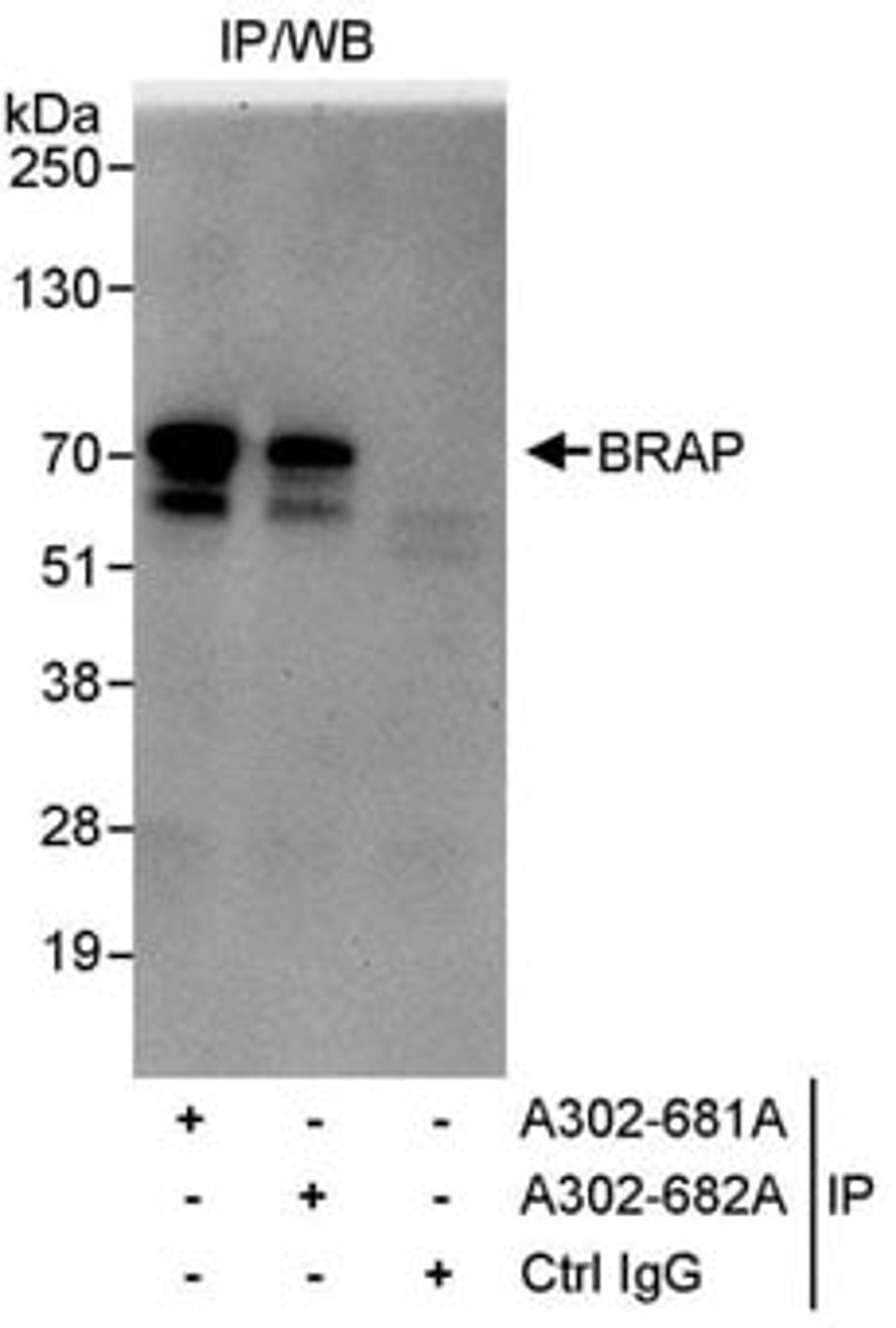 Detection of human BRAP by western blot of immunoprecipitates.