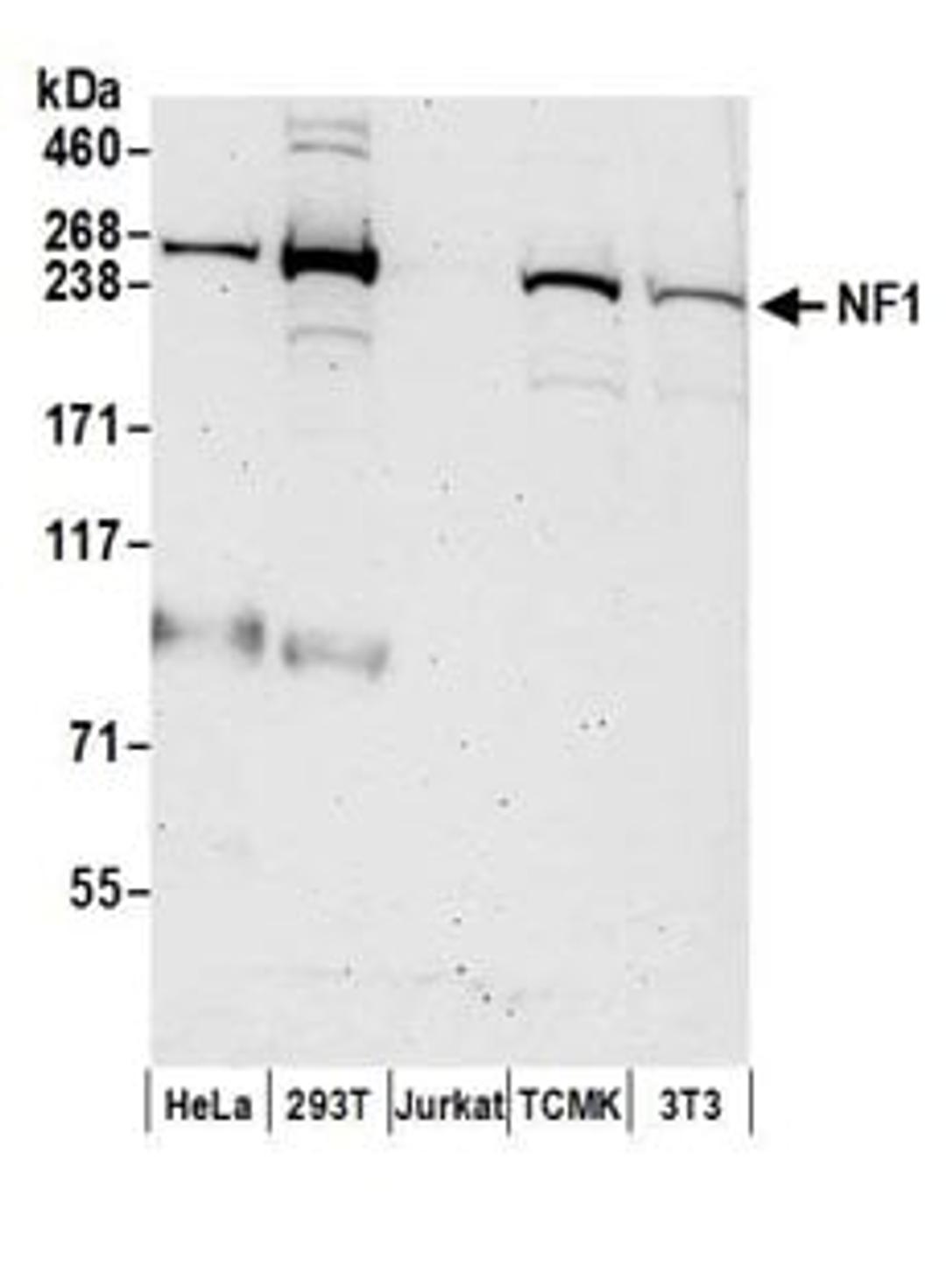 Detection of human and mouse NF1 by western blot.