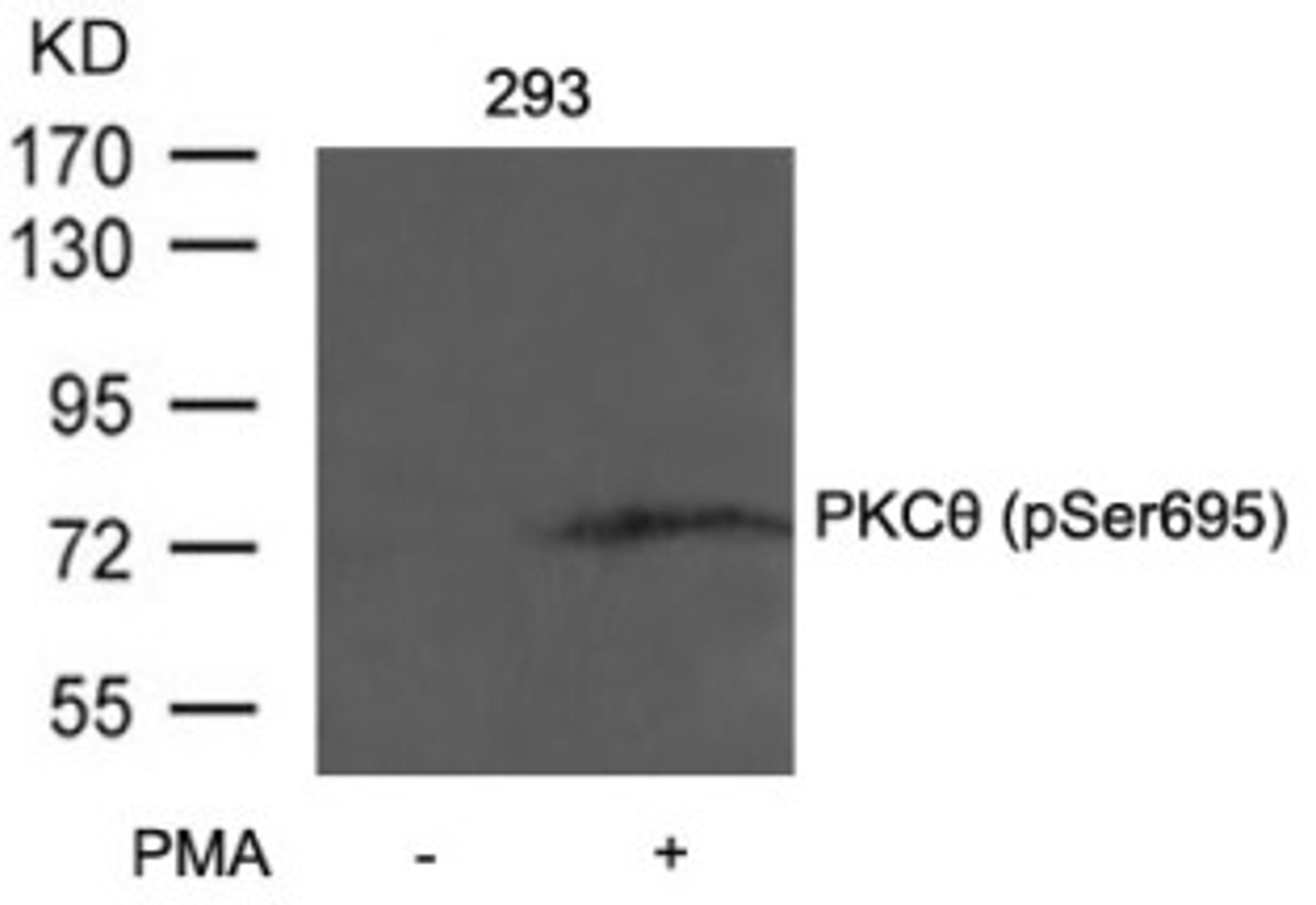 Western blot analysis of lysed extracts from 293 cells untreated or treated with PMA using PKC&#920; (Phospho-Ser695).