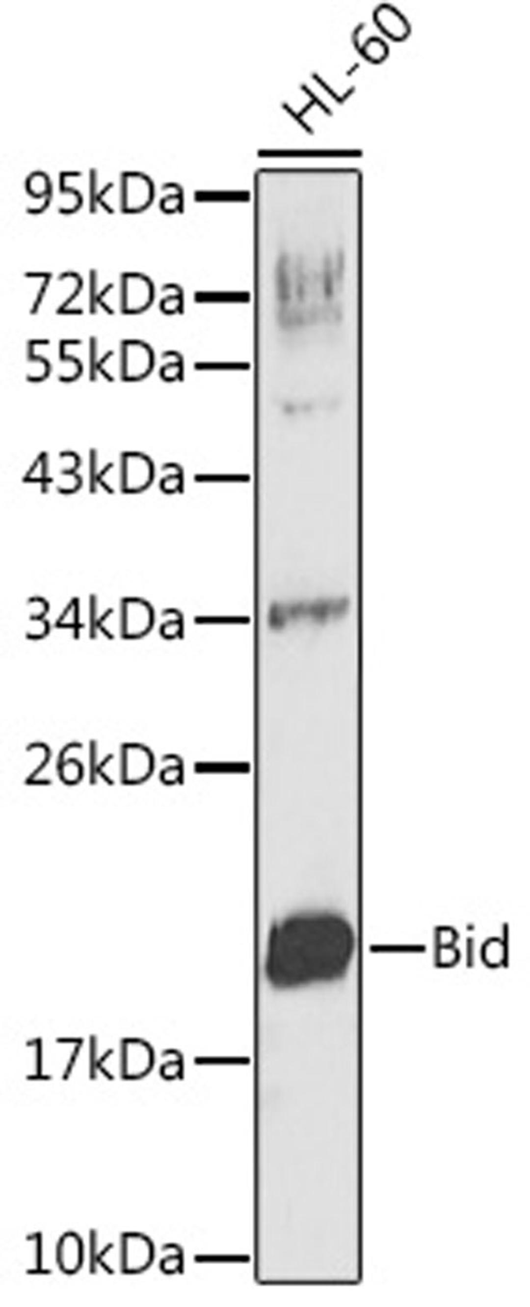 Western blot - Bid Antibody (A0210)