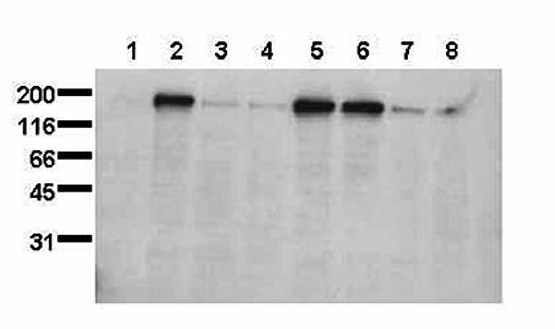 Western blot analysis of EGFR pS1047 antibody in HepG2 cells lysates