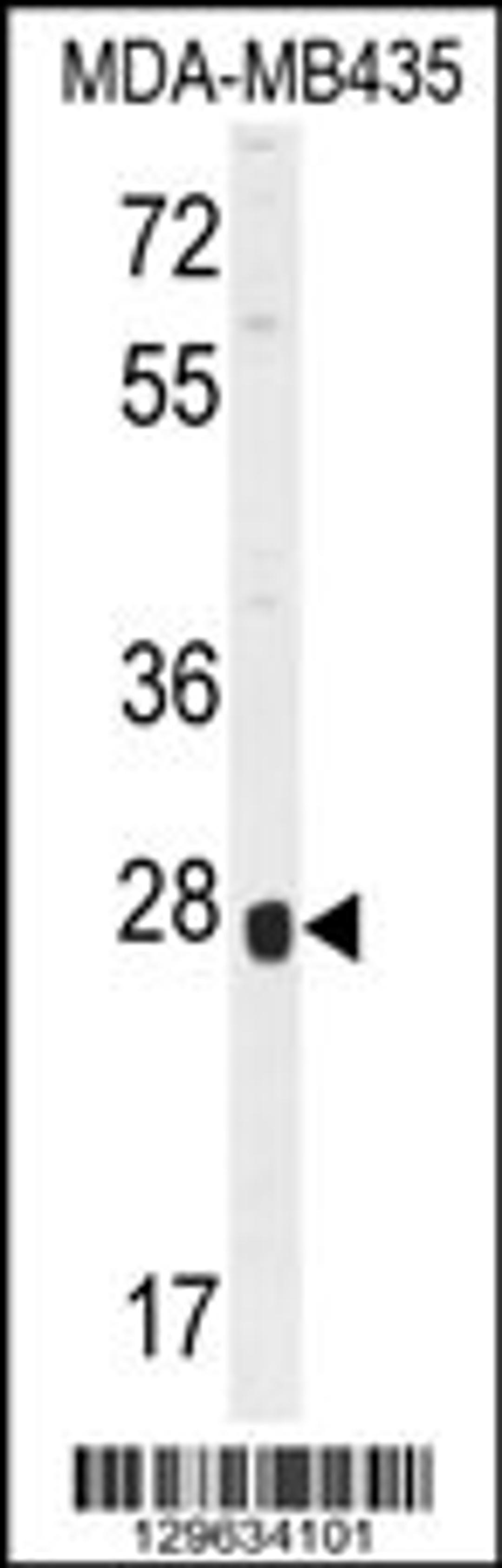 Western blot analysis in MDA-MB435 cell line lysates (35ug/lane).