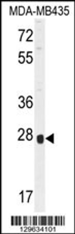 Western blot analysis in MDA-MB435 cell line lysates (35ug/lane).