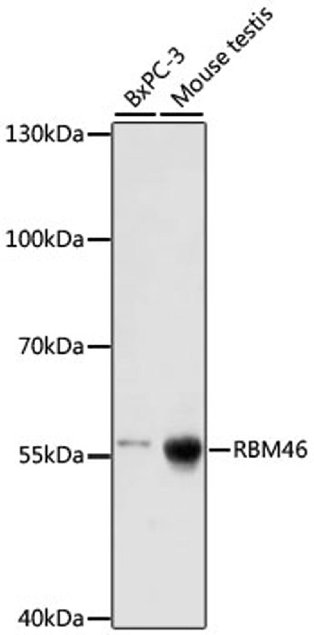 Western blot - RBM46 antibody (A16605)