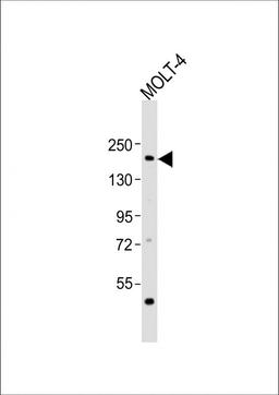 Western Blot at 1:2000 dilution + MOLT-4 whole cell lysates Lysates/proteins at 20 ug per lane.