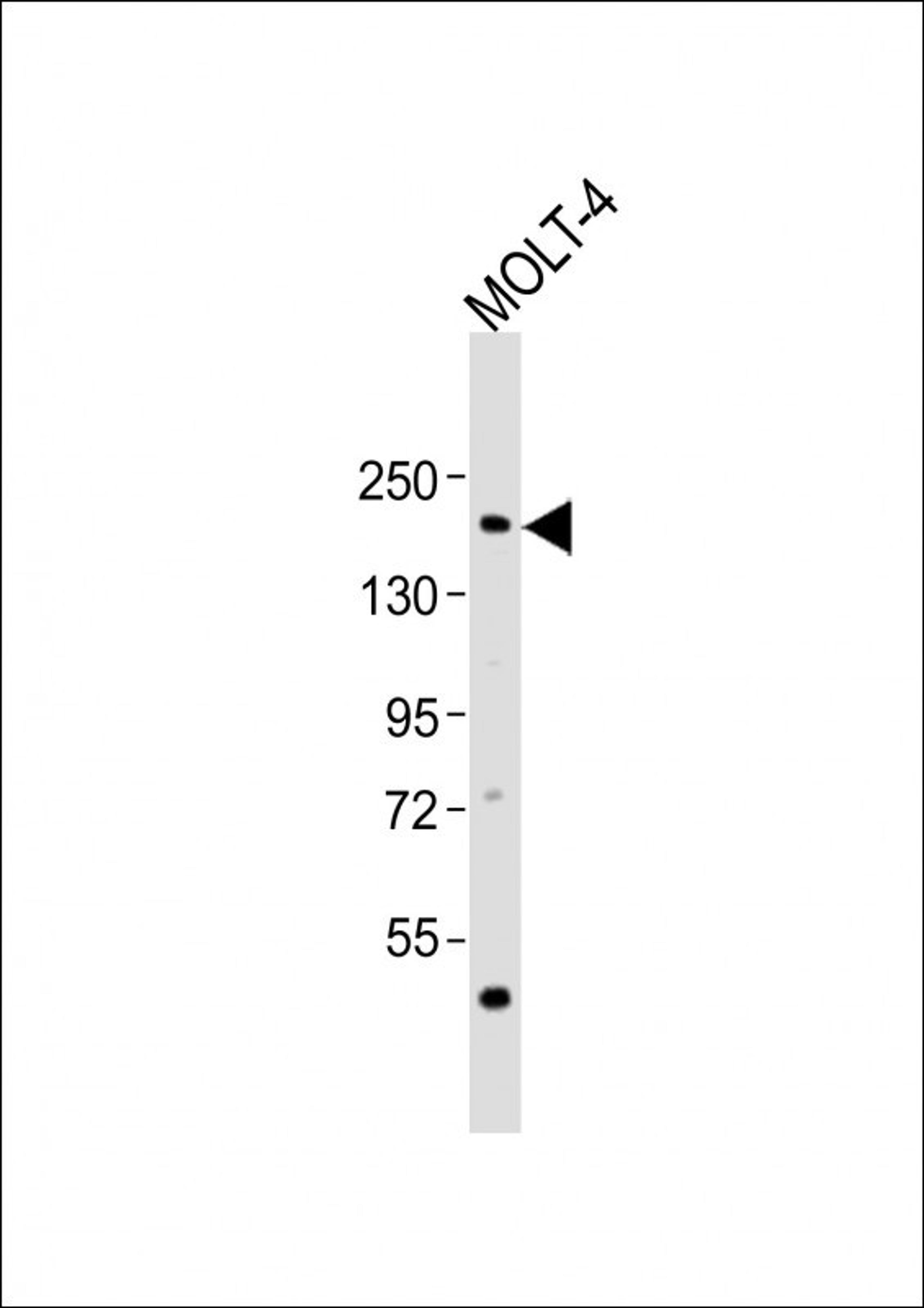 Western Blot at 1:2000 dilution + MOLT-4 whole cell lysates Lysates/proteins at 20 ug per lane.