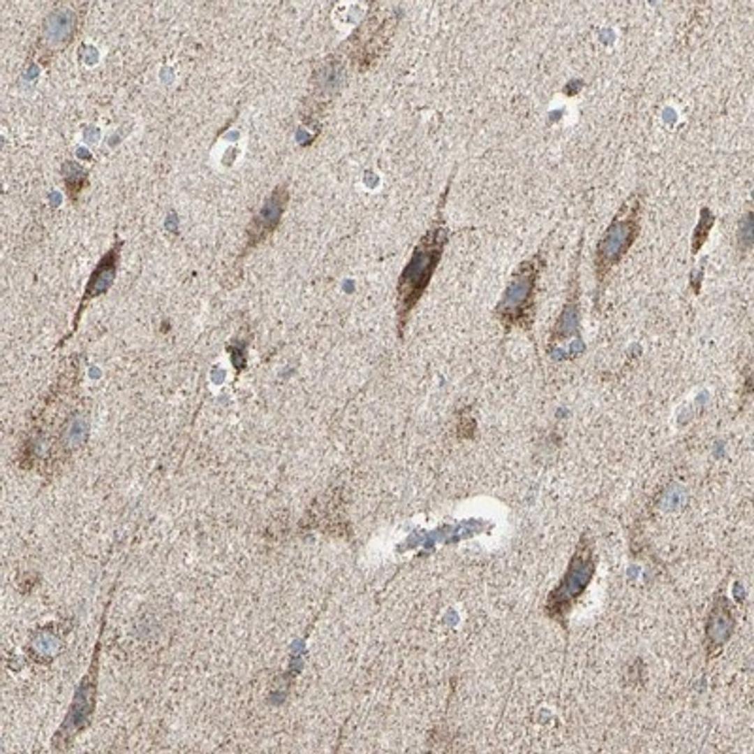 Immunohistochemistry-Paraffin: ANKS6 Antibody [NBP1-89081] - Staining of human cerebral cortex shows strong cytoplasmic positivity in granular pattern in neuronal cells.