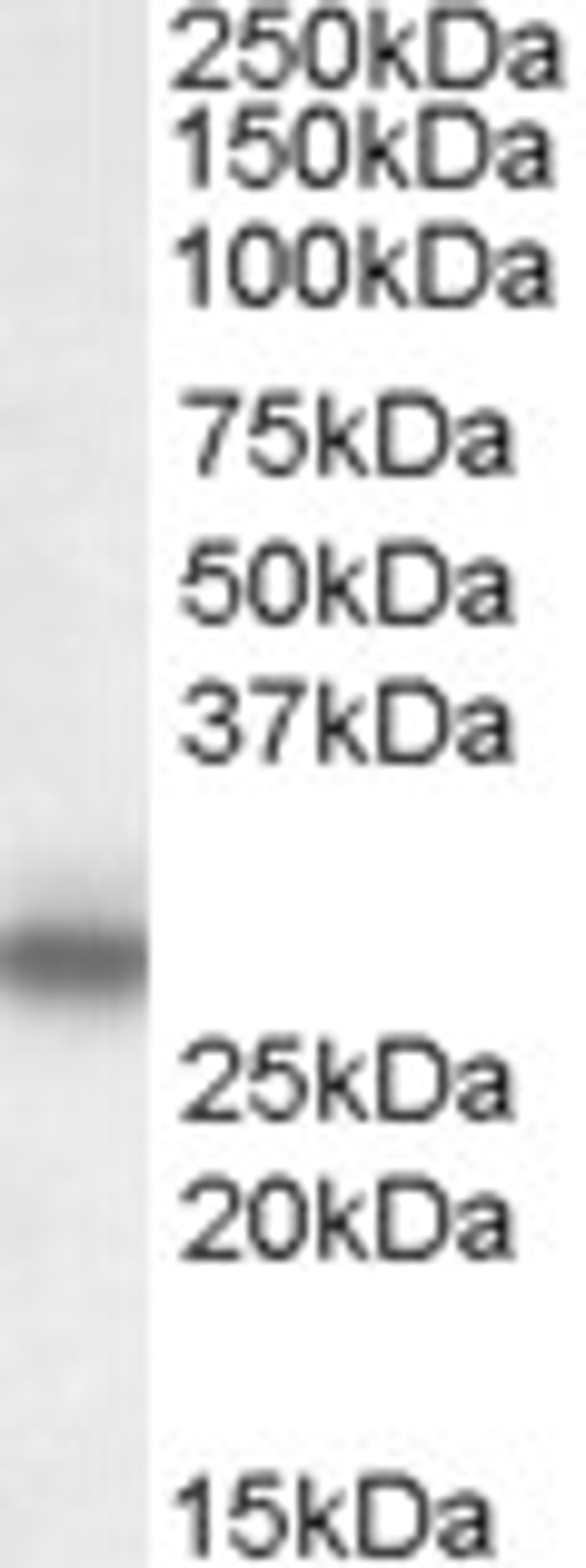 45-925 (0.1ug/ml) staining of Rat Spinal Cord lysate (35ug protein in RIPA buffer). Primary incubation was 1 hour. Detected by chemiluminescence.