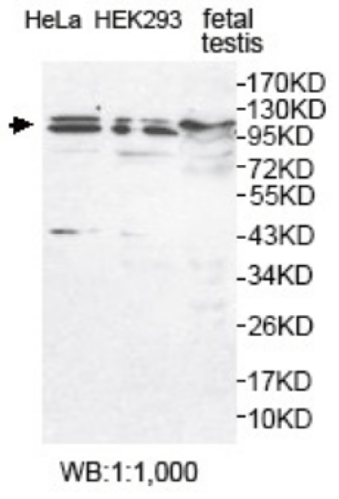 Western blot analysis of fetal testis , HeLa and HEK293 cell lysates using USP29 antibody