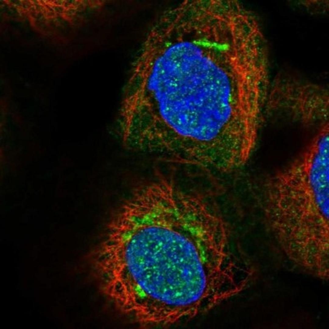 Immunocytochemistry/Immunofluorescence: KLF17 Antibody [NBP1-81917] - Staining of human cell line A-431 shows positivity in nucleus but not nucleoli & golgi apparatus.