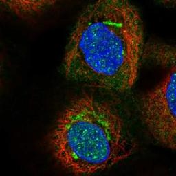 Immunocytochemistry/Immunofluorescence: KLF17 Antibody [NBP1-81917] - Staining of human cell line A-431 shows positivity in nucleus but not nucleoli & golgi apparatus.