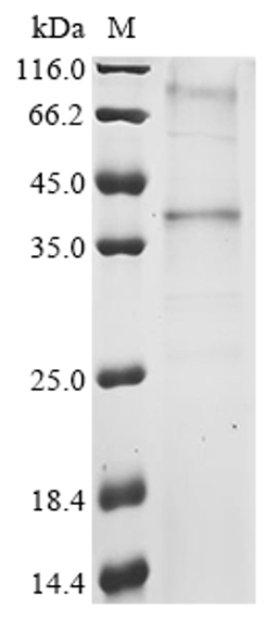 (Tris-Glycine gel) Discontinuous SDS-PAGE (reduced) with 5% enrichment gel and 15% separation gel.