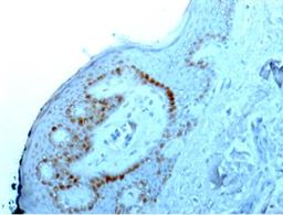 Immunohistochemistry-Paraffin: Nucleoli Marker Antibody (NM95) [NBP2-32886] - Staining of human skin.