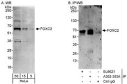 Detection of human FOXC2 by western blot and immunoprecipitation.