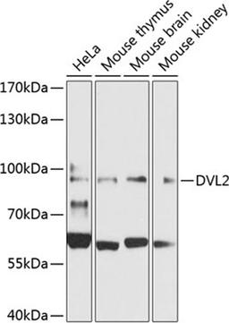 Western blot - DVL2 Antibody (A7551)