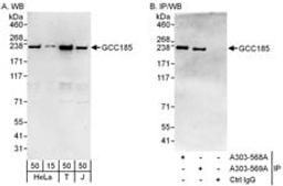 Detection of human GCC185 by western blot and immunoprecipitation.