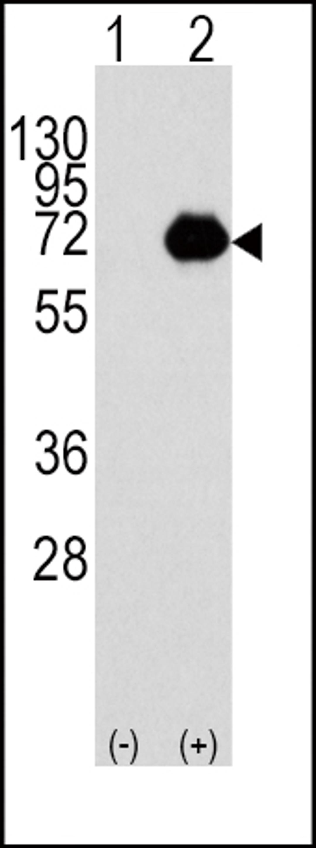 Western blot analysis of ACOX1 using rabbit polyclonal ACOX1 Antibody using 293 cell lysates (2 ug/lane) either nontransfected (Lane 1) or transiently transfected with the ACOX1 gene (Lane 2).