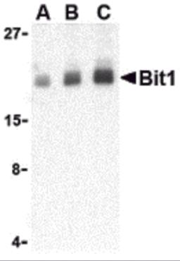 Western blot analysis of Bit1 in Daudi cell lysate with Bit1 antibody at (A) 1, (B) 2, and (C) 4 &#956;g/mL.