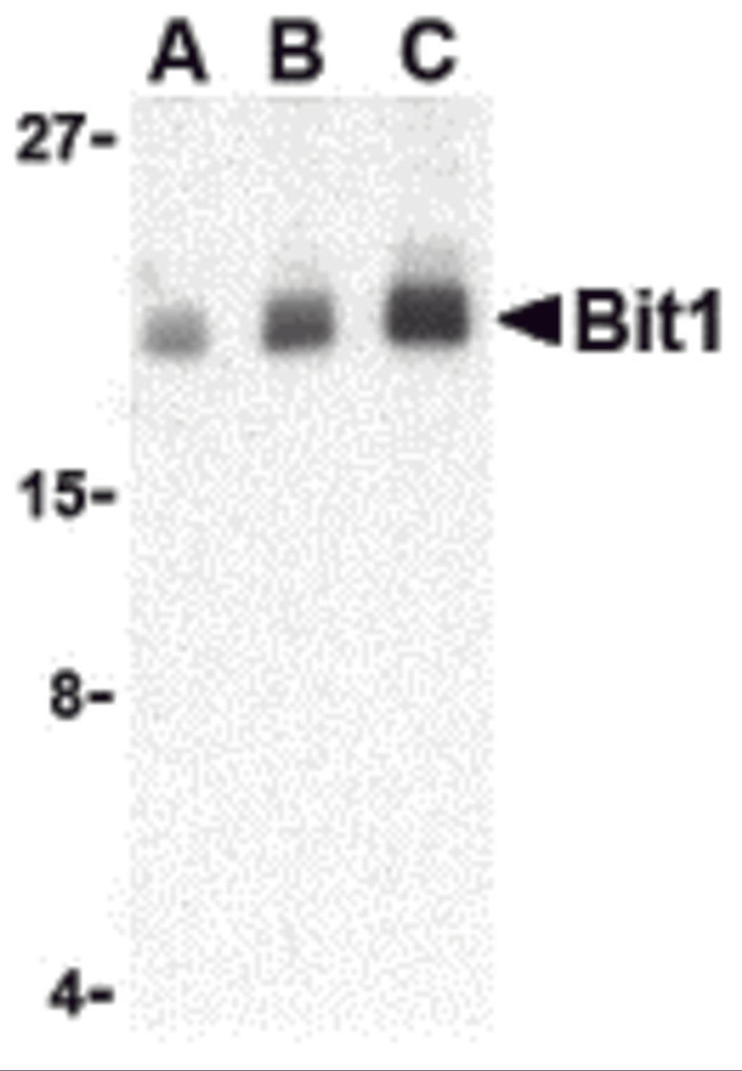 Western blot analysis of Bit1 in Daudi cell lysate with Bit1 antibody at (A) 1, (B) 2, and (C) 4 μg/mL.