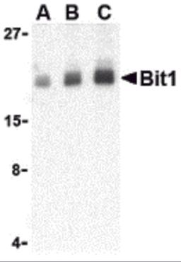 Western blot analysis of Bit1 in Daudi cell lysate with Bit1 antibody at (A) 1, (B) 2, and (C) 4 μg/mL.