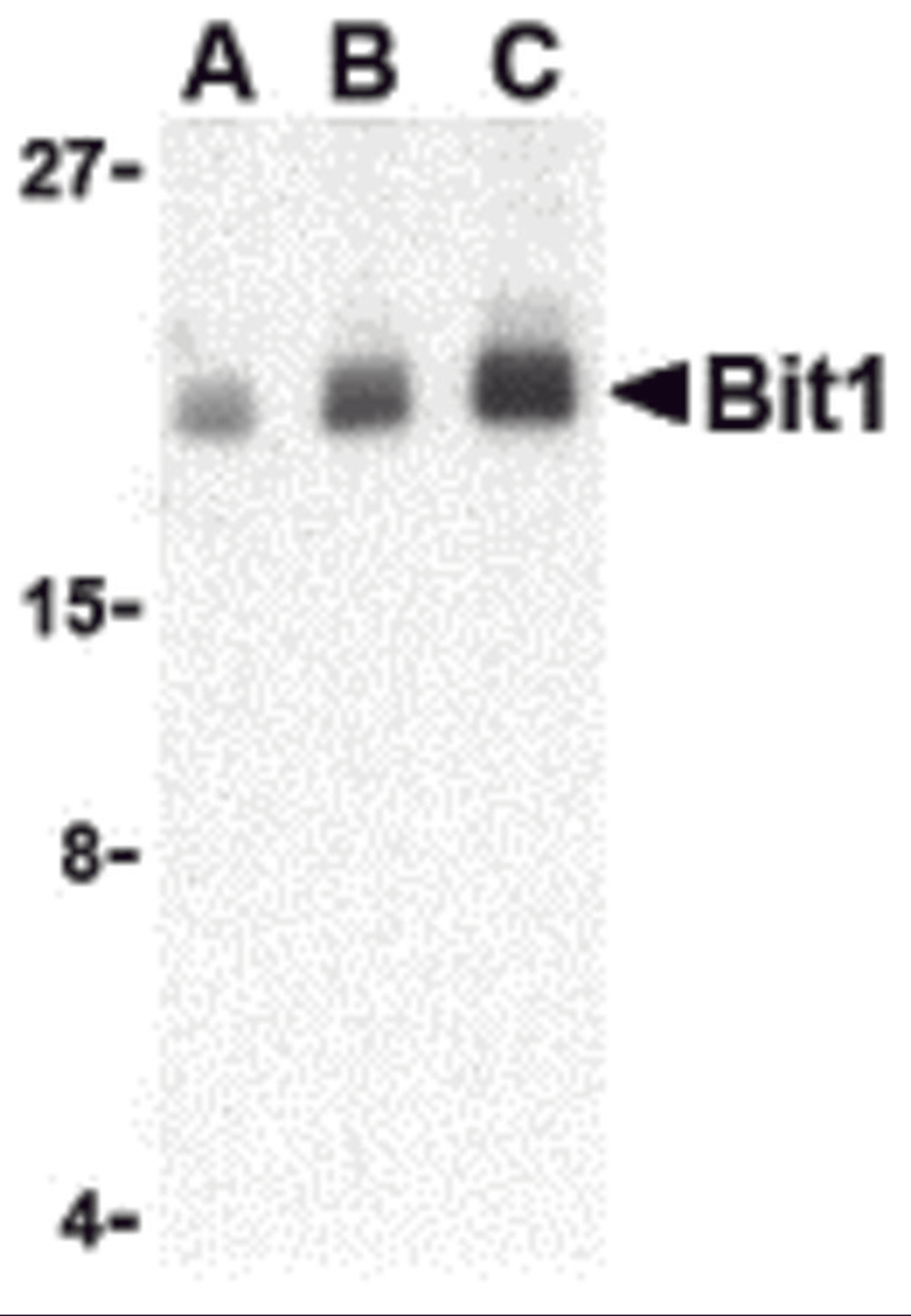 Western blot analysis of Bit1 in Daudi cell lysate with Bit1 antibody at (A) 1, (B) 2, and (C) 4 μg/mL.