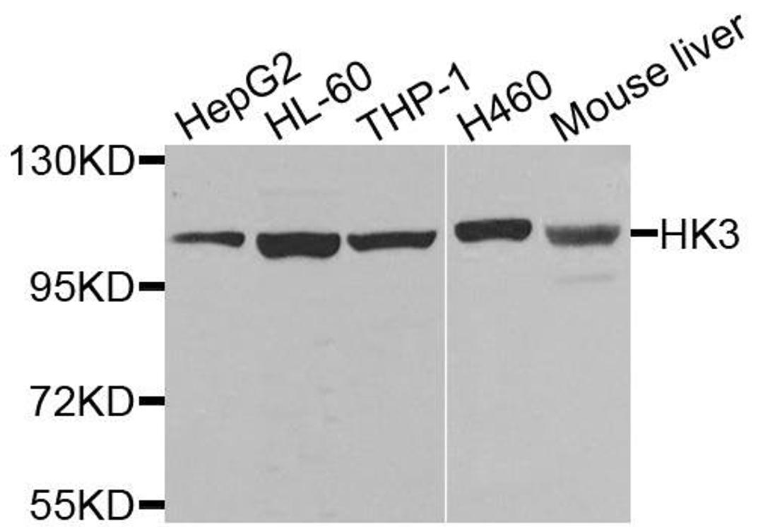 Western blot analysis of extracts of various cells using HK3 antibody