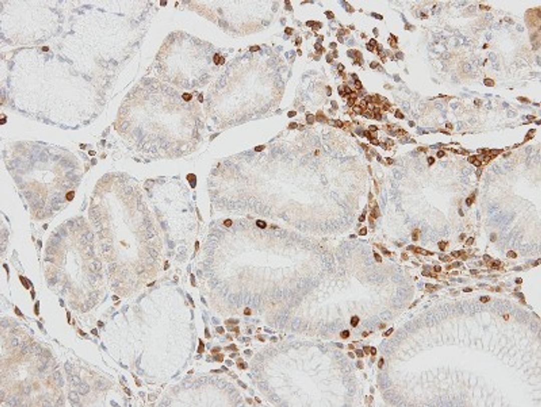 Immunohistochemistry-Paraffin: HCLS1 Antibody [NBP1-30953] - Paraffin-embedded Lymphocytes in gastric epithelium, using antibody at 1:100 dilution.