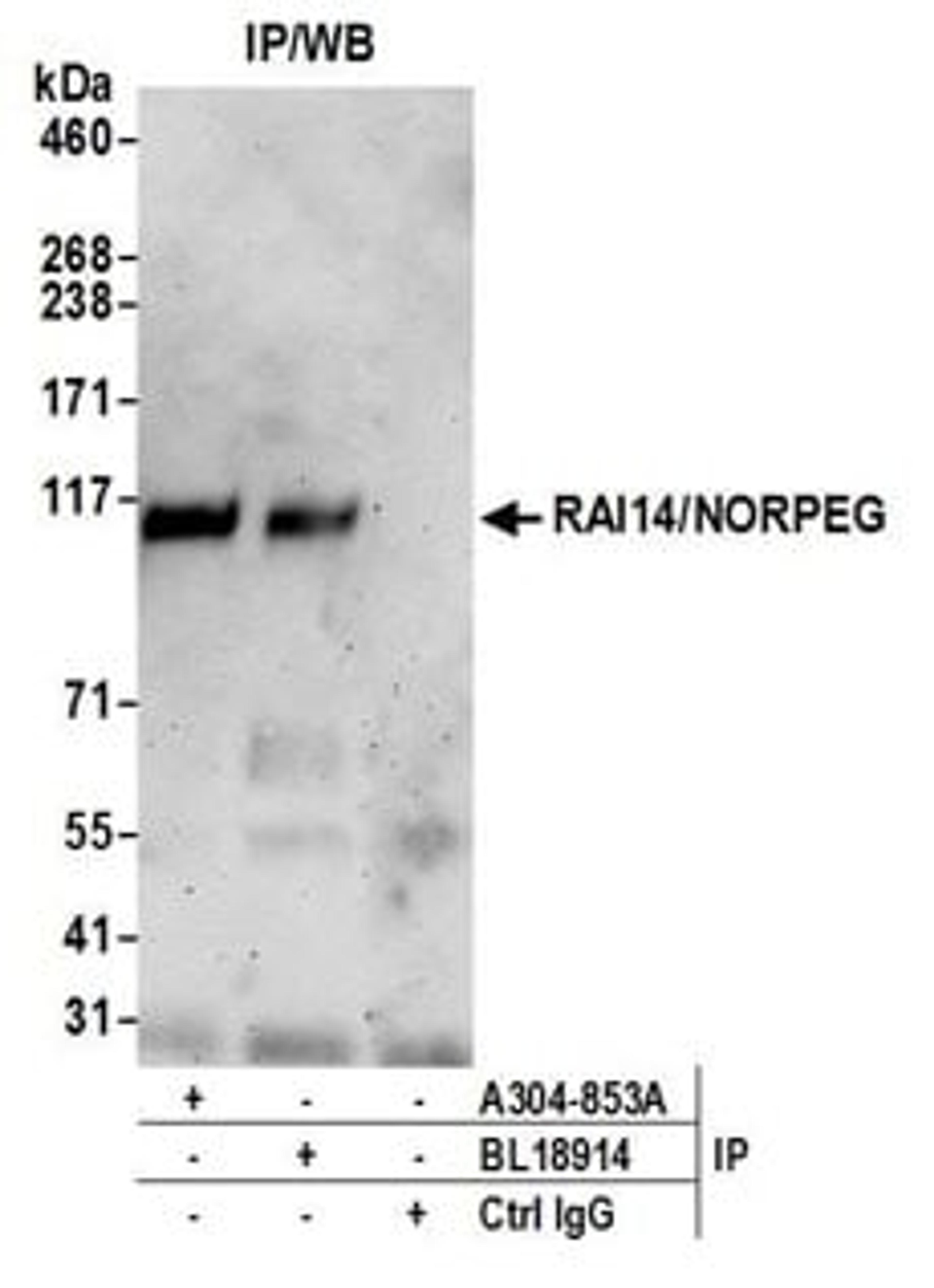 Detection of human RAI14/NORPEG by western blot of immunoprecipitates.