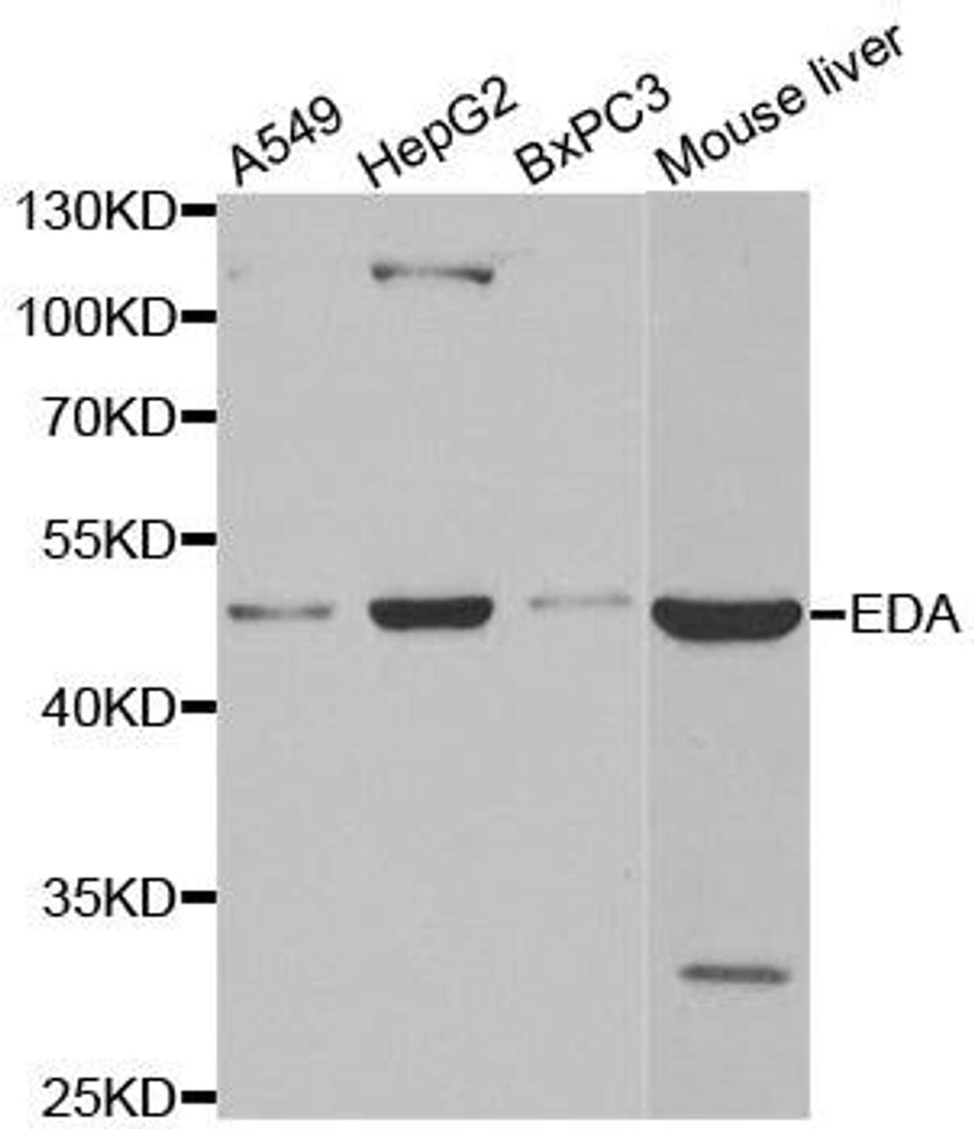 Western blot analysis of extracts of various cell lines using EDA antibody