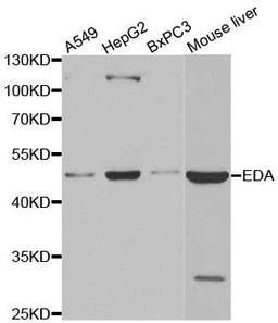 Western blot analysis of extracts of various cell lines using EDA antibody