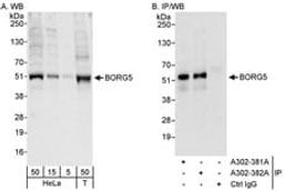 Detection of human BORG5 by western blot and immunoprecipitation.