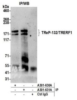 Detection of human TReP-132/TRERF1 by western blot of immunoprecipitates.