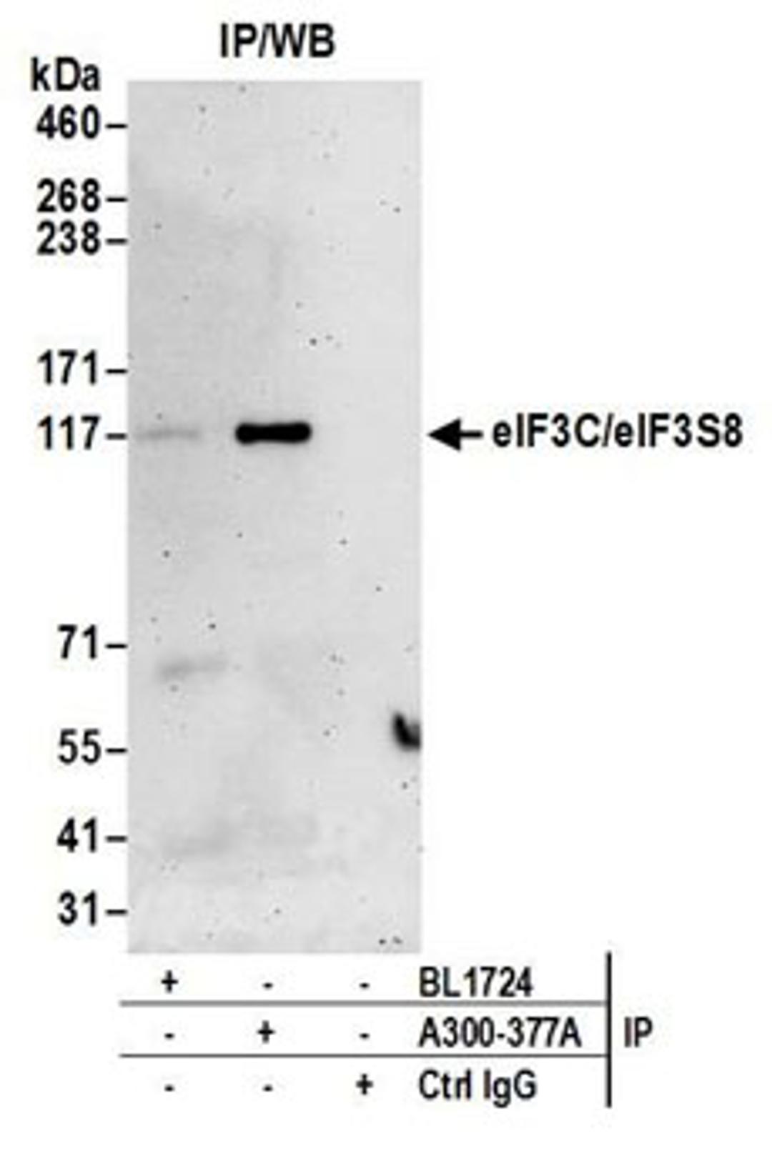 Detection of human eIF3C/eIF3S8 by western blot of immunoprecipitates.