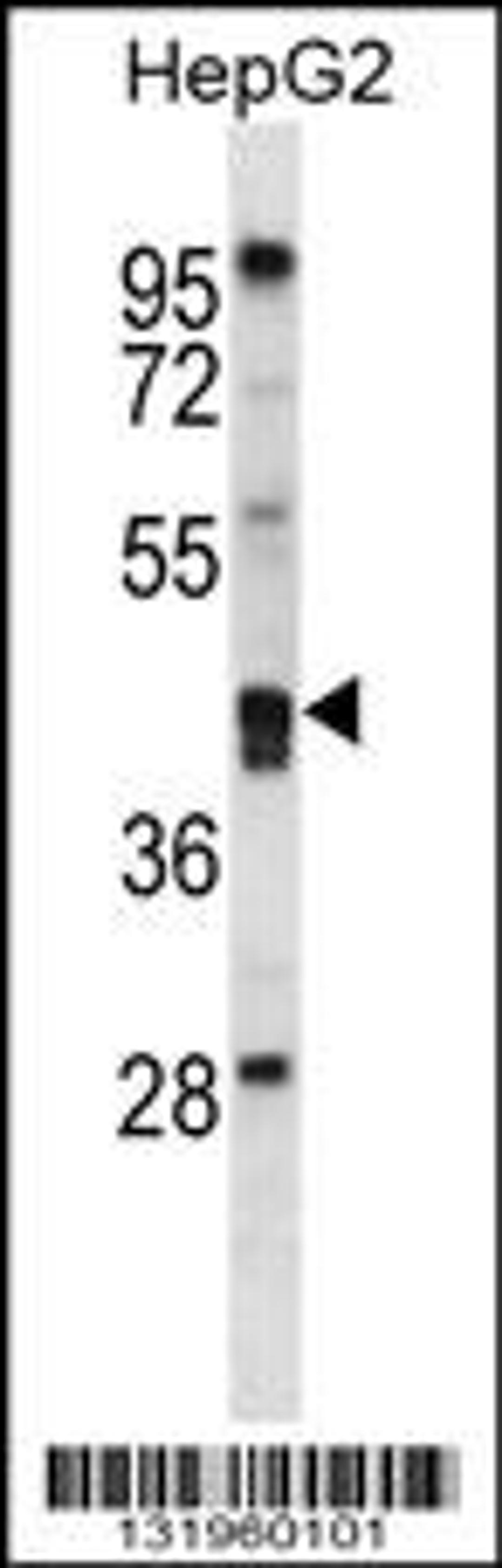 Western blot analysis in HepG2 cell line lysates (35ug/lane).