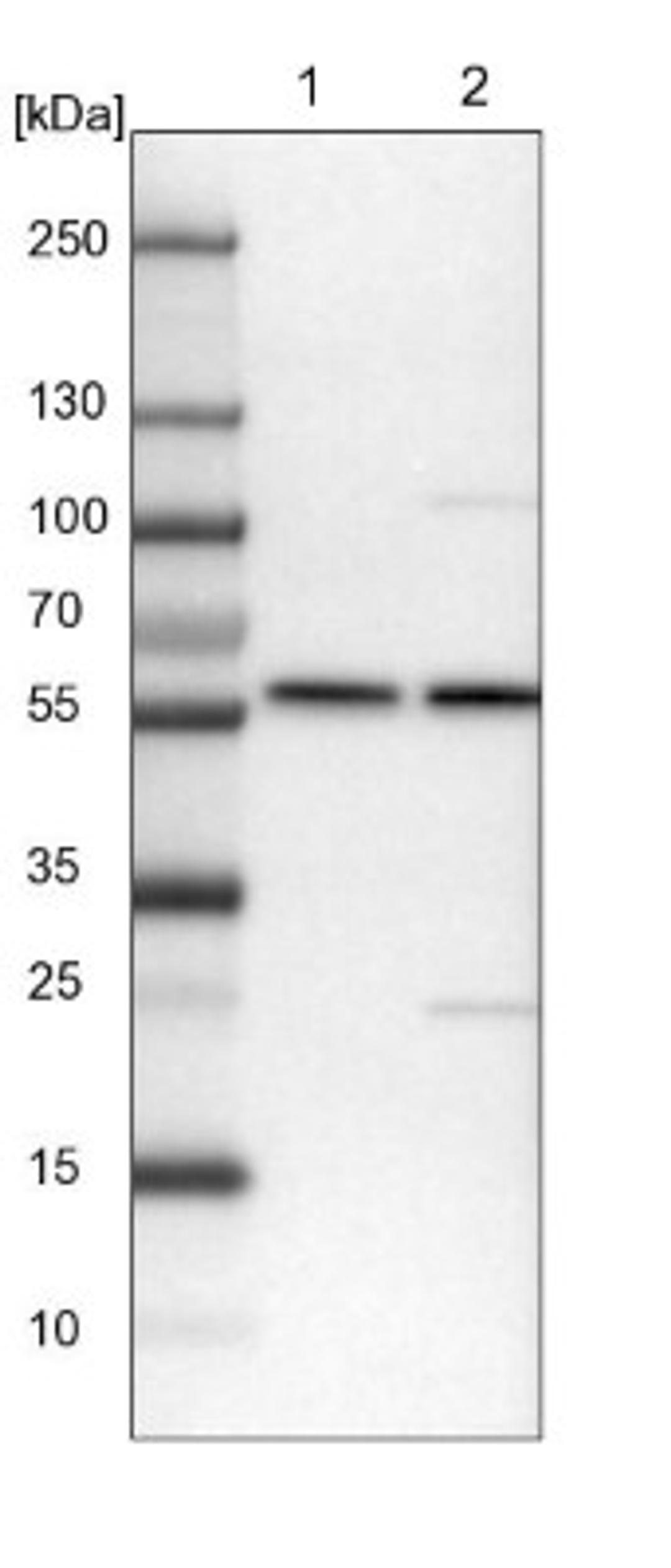 Western Blot: DDX19A Antibody [NBP1-91824] - Lane 1: NIH-3T3 cell lysate (Mouse embryonic fibroblast cells)<br/>Lane 2: NBT-II cell lysate (Rat Wistar bladder tumour cells)