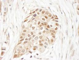 Detection of human Ubiquitin by immunohistochemistry.