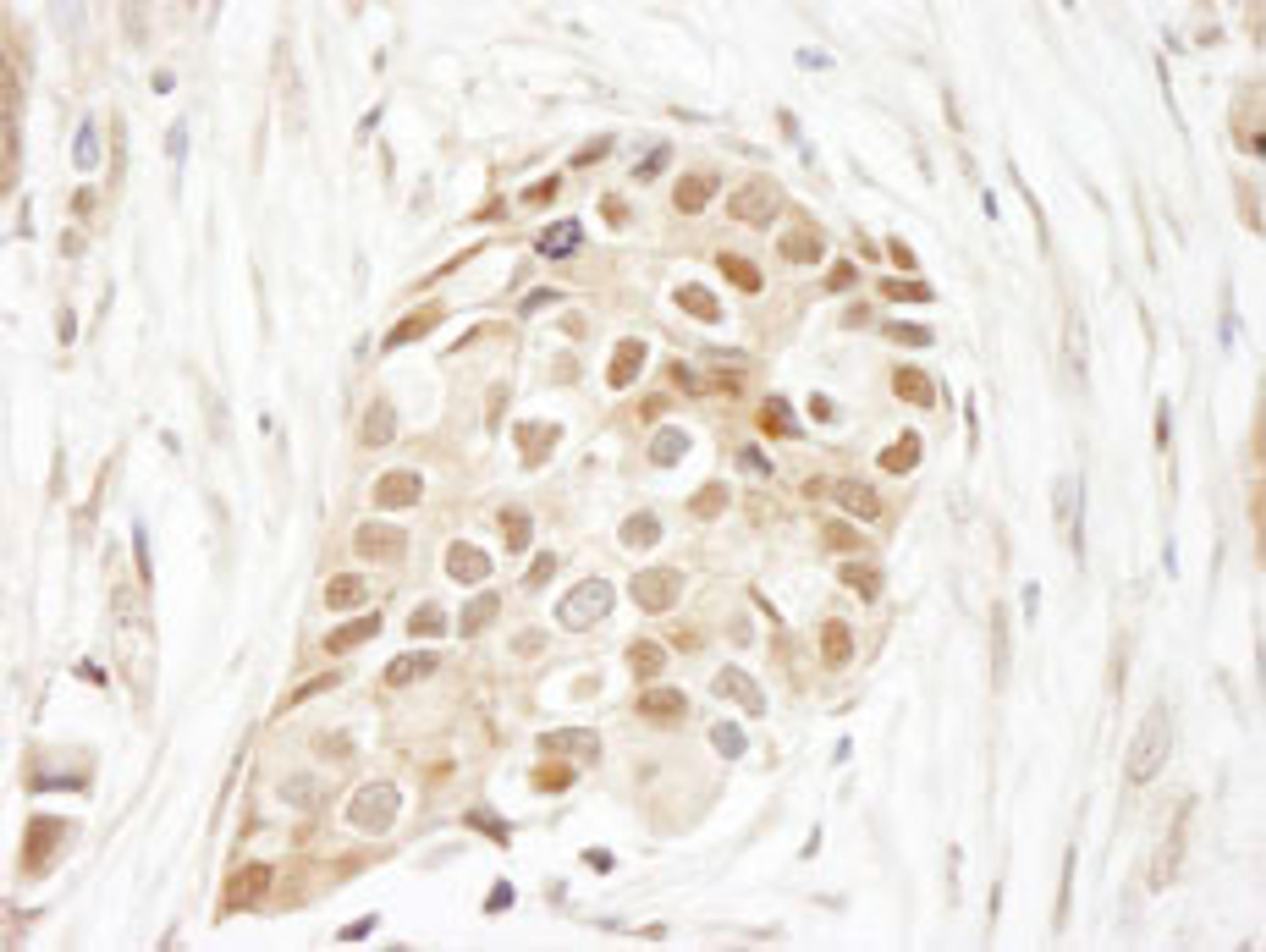 Detection of human Ubiquitin by immunohistochemistry.