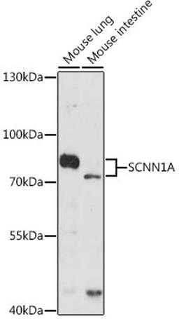 Western blot - SCNN1A antibody (A5538)