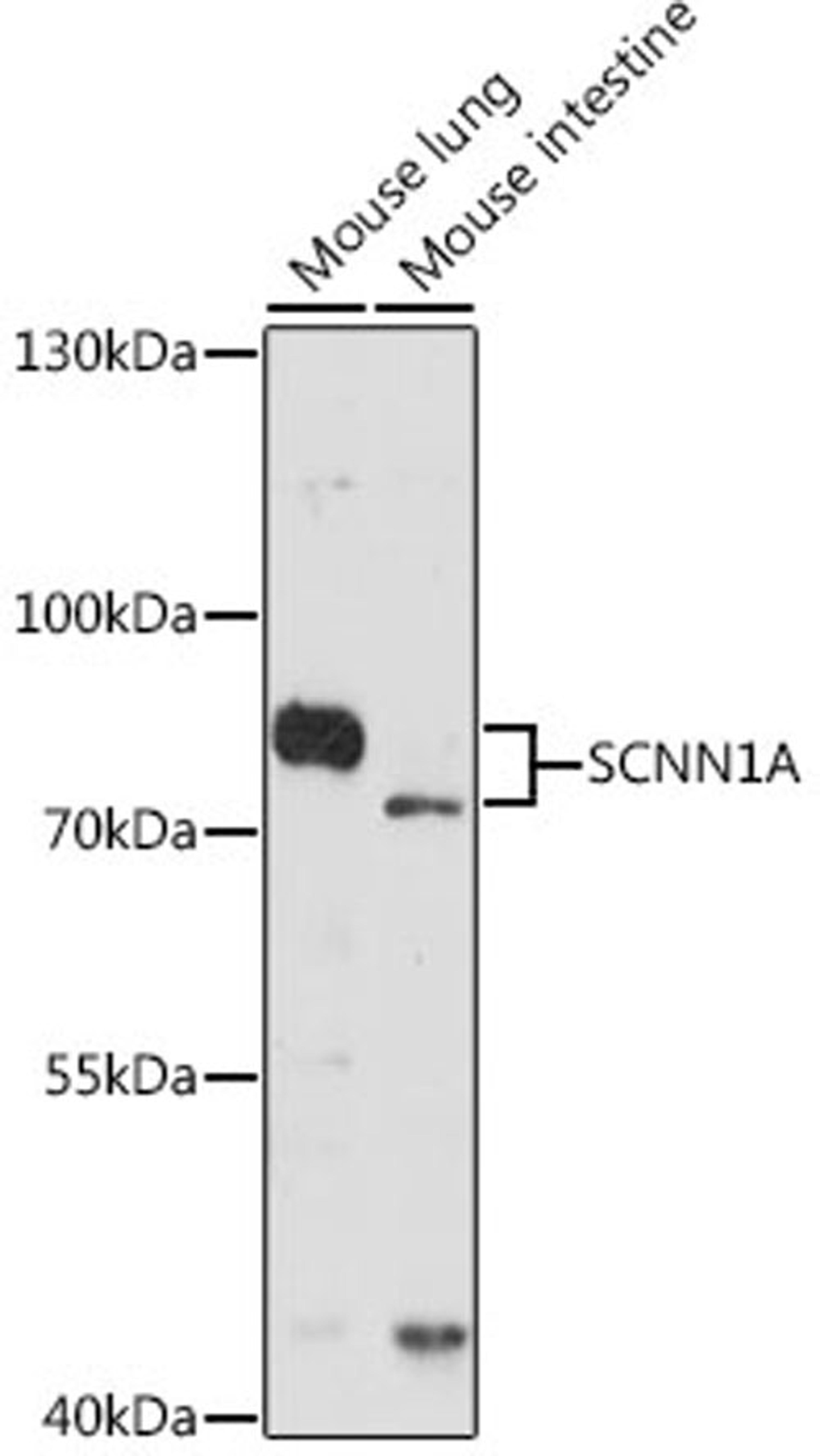 Western blot - SCNN1A antibody (A5538)