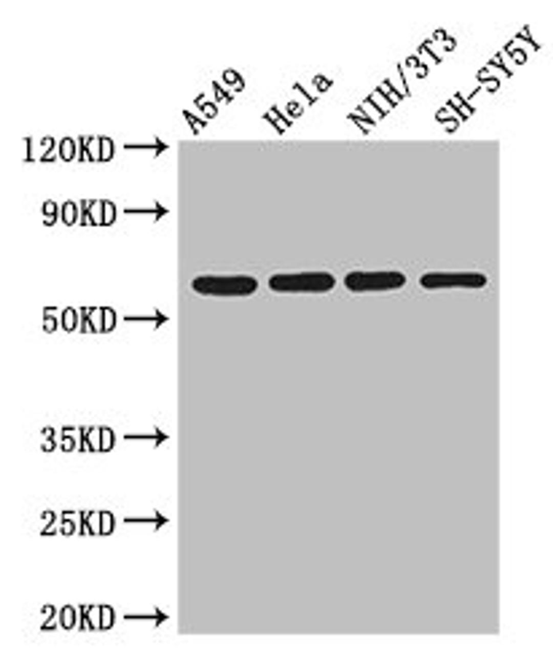 Western Blot. Positive WB detected in: A549 whole cell lysate, Hela whole cell lysate, NIH/3T3 whole cell lysate, SH-SY5Y whole cell lysate. All lanes: IRF5 antibody at 3ug/ml. Secondary. Goat polyclonal to rabbit IgG at 1/50000 dilution. Predicted band size: 57, 58, 55, 48, 18 kDa. Observed band size: 57 kDa. 