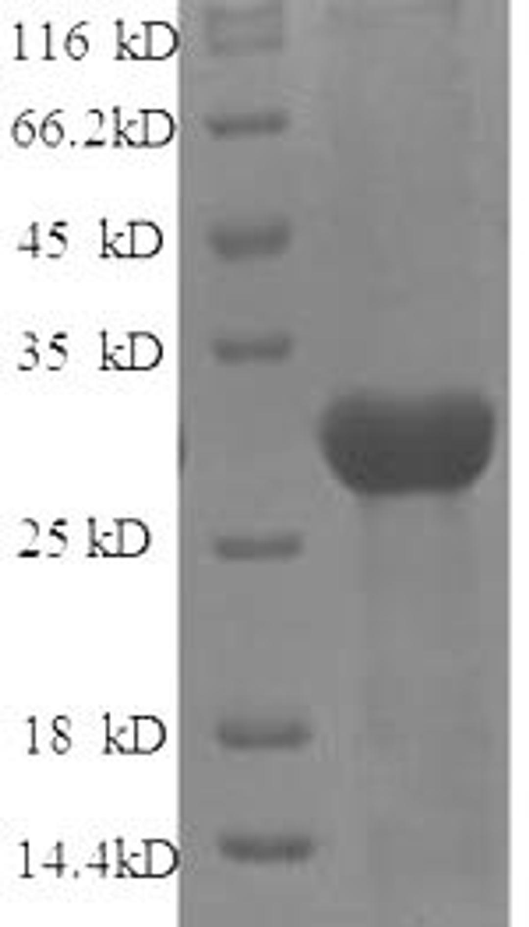 (Tris-Glycine gel) Discontinuous SDS-PAGE (reduced) with 5% enrichment gel and 15% separation gel.
