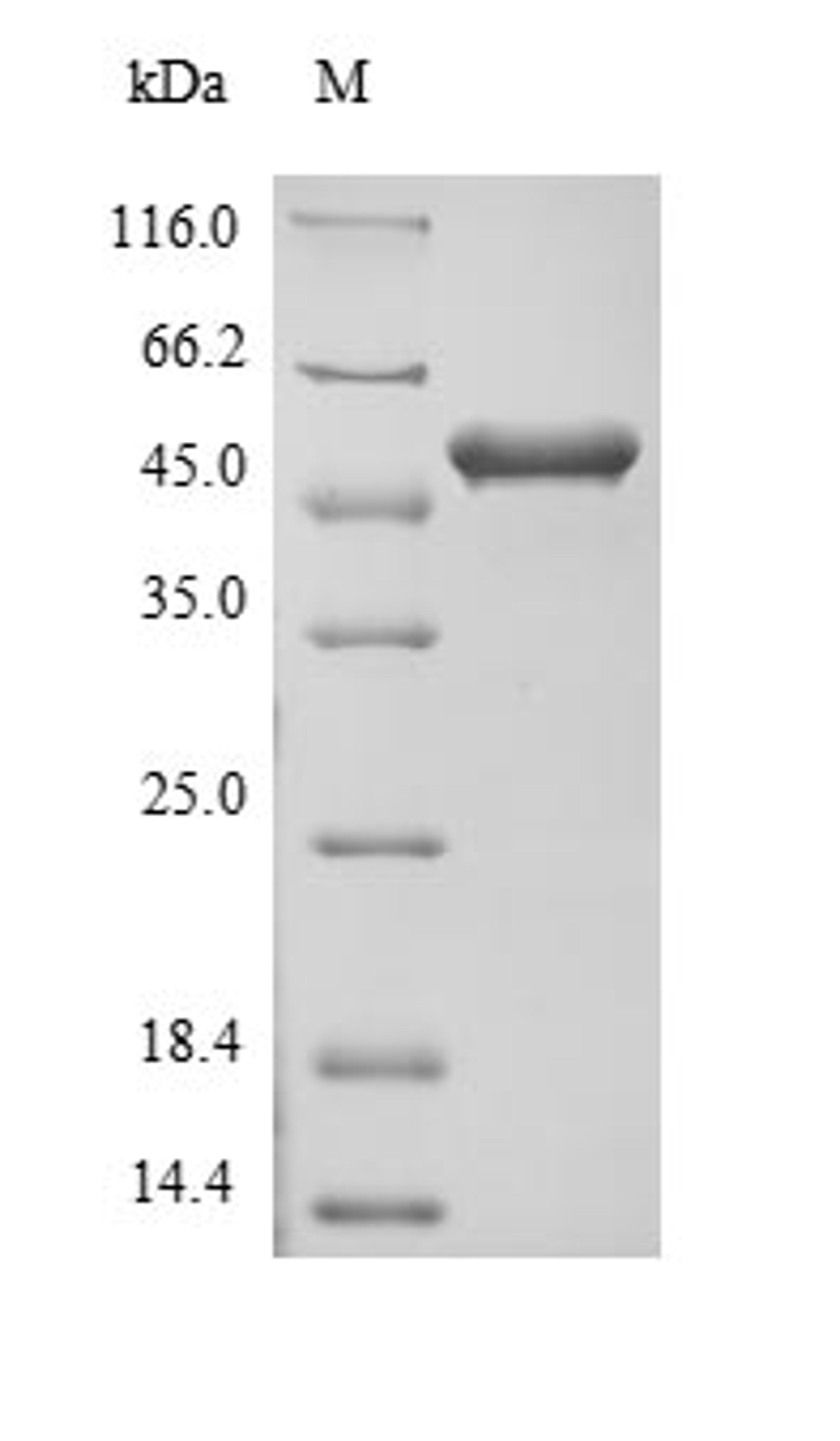 (Tris-Glycine gel) Discontinuous SDS-PAGE (reduced) with 5% enrichment gel and 15% separation gel.