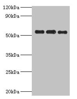 Western blot. All lanes: PDHX antibody at 6ug/ml. Lane 1: 293T whole cell lysate. Lane 2: PC-3 whole cell lysate. Lane 3: MCF-7 whole cell lysate. Secondary. Goat polyclonal to rabbit IgG at 1/10000 dilution. Predicted band size: 55, 30, 52 kDa. Observed band size: 55 kDa.