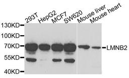 Western blot analysis of extracts of various cells using LMNB2 antibody