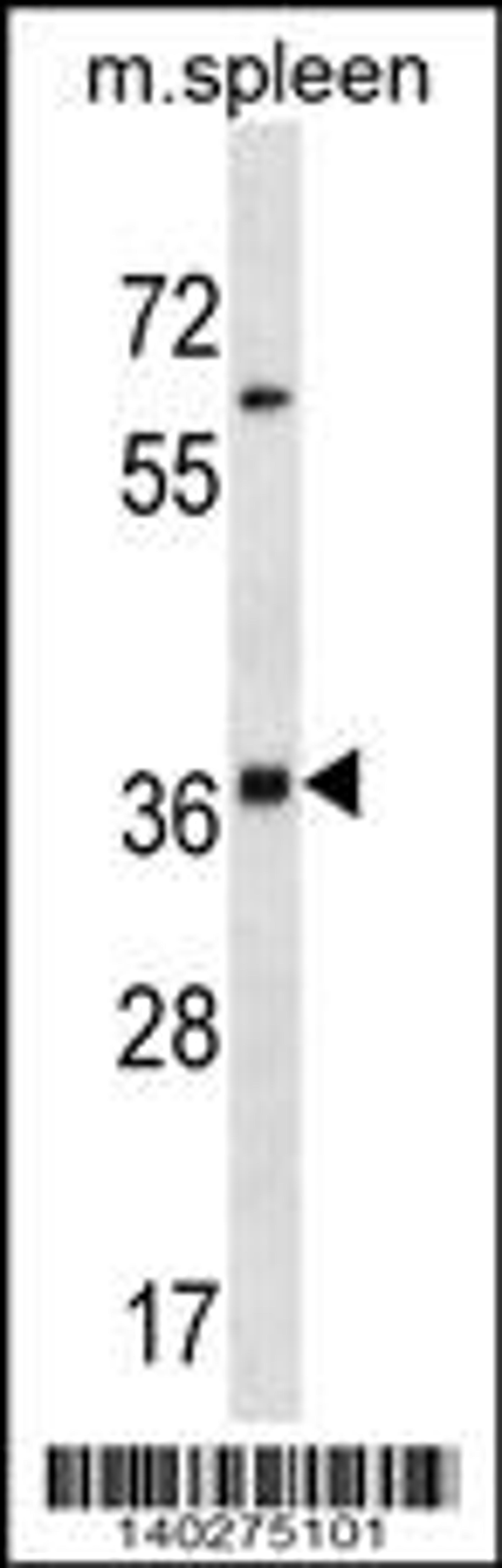 Western blot analysis in mouse spleen tissue lysates (35ug/lane).