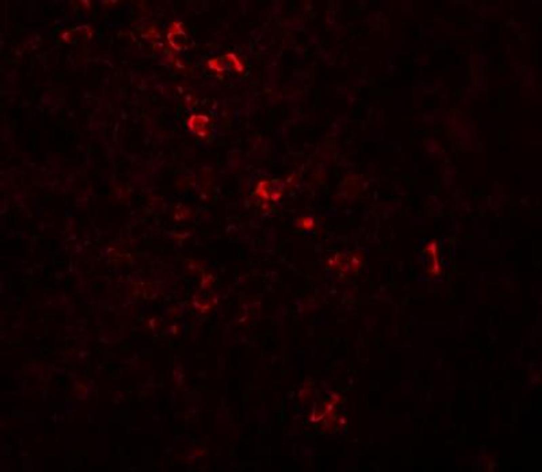 Immunocytochemistry/Immunofluorescence: ZBTB8 Antibody [NBP1-76521] - Immunofluorescence of ZBTB8 in human spleen tissue with ZBTB8 antibody at 20 ug/mL.