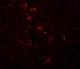 Immunocytochemistry/Immunofluorescence: ZBTB8 Antibody [NBP1-76521] - Immunofluorescence of ZBTB8 in human spleen tissue with ZBTB8 antibody at 20 ug/mL.