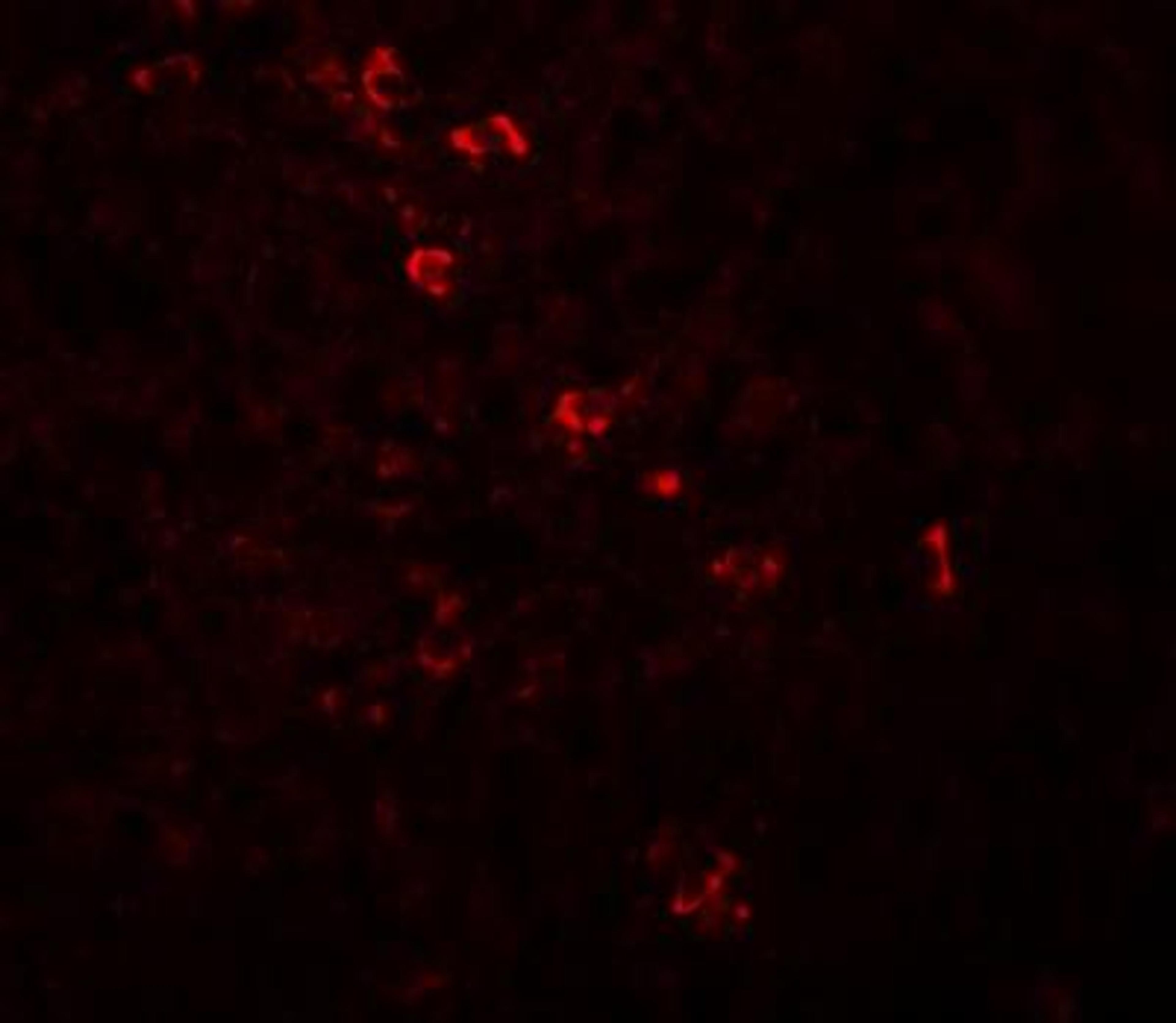 Immunocytochemistry/Immunofluorescence: ZBTB8 Antibody [NBP1-76521] - Immunofluorescence of ZBTB8 in human spleen tissue with ZBTB8 antibody at 20 ug/mL.